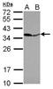 Pyrophosphatase (Inorganic) 1 antibody, GTX114651, GeneTex, Western Blot image 