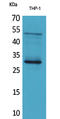 Fibroblast Growth Factor 23 antibody, STJ96536, St John