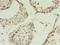 Claudin 15 antibody, A50125-100, Epigentek, Immunohistochemistry paraffin image 