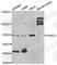Protein Kinase D3 antibody, A7084, ABclonal Technology, Western Blot image 