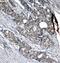 p53 antibody, 79-145, ProSci, Immunohistochemistry frozen image 