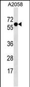 Synaptotagmin 4 antibody, PA5-49193, Invitrogen Antibodies, Western Blot image 