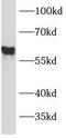 Transforming Growth Factor Beta Receptor 1 antibody, FNab08643, FineTest, Western Blot image 