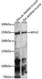 Myosin Heavy Chain 2 antibody, A15292, ABclonal Technology, Western Blot image 