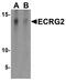 Serine Peptidase Inhibitor, Kazal Type 7 (Putative) antibody, PA5-72716, Invitrogen Antibodies, Western Blot image 
