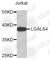 Galectin 4 antibody, A3946, ABclonal Technology, Western Blot image 