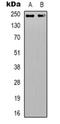 Death Inducer-Obliterator 1 antibody, orb318986, Biorbyt, Western Blot image 