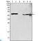 Glutamic-Oxaloacetic Transaminase 2 antibody, LS-C812483, Lifespan Biosciences, Immunofluorescence image 