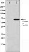 Ezrin antibody, orb106058, Biorbyt, Western Blot image 