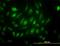 Ubiquitin Specific Peptidase 33 antibody, orb94689, Biorbyt, Immunofluorescence image 