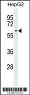 Peroxisome Proliferator Activated Receptor Delta antibody, 56-129, ProSci, Western Blot image 