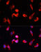 Calcium/Calmodulin Dependent Protein Kinase II Gamma antibody, 19-002, ProSci, Immunofluorescence image 
