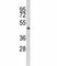 Integrin Linked Kinase antibody, F50640-0.4ML, NSJ Bioreagents, Western Blot image 