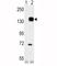 TEK Receptor Tyrosine Kinase antibody, F50680-0.4ML, NSJ Bioreagents, Immunohistochemistry paraffin image 