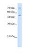 Lipopolysaccharide Binding Protein antibody, orb330192, Biorbyt, Western Blot image 