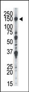 NIMA Related Kinase 1 antibody, AP15020PU-N, Origene, Western Blot image 