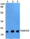 TGFB Induced Factor Homeobox 2 Like Y-Linked antibody, PA5-75718, Invitrogen Antibodies, Western Blot image 