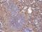 CD70 Molecule antibody, A02853-2, Boster Biological Technology, Immunohistochemistry paraffin image 