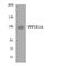 Protein Phosphatase 1 Regulatory Subunit 3A antibody, LS-C200511, Lifespan Biosciences, Western Blot image 