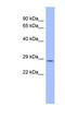 Proteasome Subunit Beta 10 antibody, NBP1-58937, Novus Biologicals, Western Blot image 