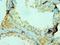 Collagen Type X Alpha 1 Chain antibody, LS-C375484, Lifespan Biosciences, Immunohistochemistry frozen image 