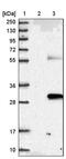 Membrane Spanning 4-Domains A3 antibody, PA5-53956, Invitrogen Antibodies, Western Blot image 