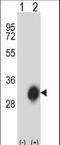 Major Histocompatibility Complex, Class II, DP Beta 1 antibody, LS-C164914, Lifespan Biosciences, Western Blot image 