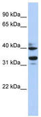 Zinc Finger Protein 550 antibody, TA341505, Origene, Western Blot image 