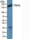 Insulin receptor substrate 2 antibody, LS-C688166, Lifespan Biosciences, Western Blot image 