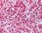 Transient Receptor Potential Cation Channel Subfamily M Member 8 antibody, PA1-46239, Invitrogen Antibodies, Immunohistochemistry frozen image 