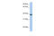 Aquaporin 10 antibody, 26-497, ProSci, Western Blot image 