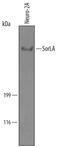 Sortilin Related Receptor 1 antibody, PA5-47765, Invitrogen Antibodies, Western Blot image 