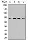 Protein O-Linked Mannose N-Acetylglucosaminyltransferase 1 (Beta 1,2-) antibody, orb412916, Biorbyt, Western Blot image 