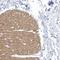 Zinc Finger Protein 846 antibody, HPA034618, Atlas Antibodies, Immunohistochemistry frozen image 