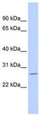 Zinc Finger Protein 575 antibody, TA335363, Origene, Western Blot image 