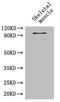 Glycogen Phosphorylase B antibody, A51994-100, Epigentek, Western Blot image 