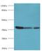 Arginase 2 antibody, MBS1498923, MyBioSource, Western Blot image 