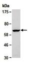 Neurofilament Light antibody, orb66923, Biorbyt, Western Blot image 