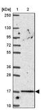 Protein C19orf84  antibody, NBP2-38114, Novus Biologicals, Western Blot image 