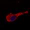Neurofilament Medium antibody, LS-C45928, Lifespan Biosciences, Immunocytochemistry image 