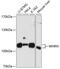 Whirlin antibody, A32322, Boster Biological Technology, Western Blot image 