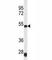 Serpin Family H Member 1 antibody, F40219-0.4ML, NSJ Bioreagents, Western Blot image 
