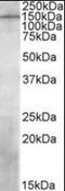 Phosphatidylinositol-3,4,5-Trisphosphate Dependent Rac Exchange Factor 1 antibody, orb94743, Biorbyt, Western Blot image 