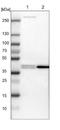 Protein Arginine Methyltransferase 2 antibody, NBP1-83206, Novus Biologicals, Western Blot image 