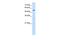 Serine Hydroxymethyltransferase 2 antibody, GTX46482, GeneTex, Western Blot image 