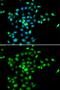 SBDS Ribosome Maturation Factor antibody, GTX64702, GeneTex, Immunocytochemistry image 