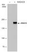 Histone Deacetylase 6 antibody, GTX100722, GeneTex, Western Blot image 