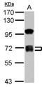 Zinc Finger Protein 182 antibody, NBP2-20968, Novus Biologicals, Western Blot image 