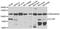 Chloride Voltage-Gated Channel 7 antibody, STJ28966, St John