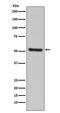 Programmed Cell Death 4 antibody, M01105, Boster Biological Technology, Western Blot image 